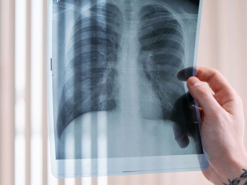 Switching from cigs to ecigs does not significantly reduce lung cancer&nbsp;risk